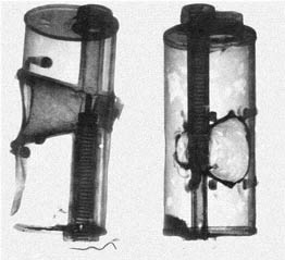 Radiografia de la granada Laffite